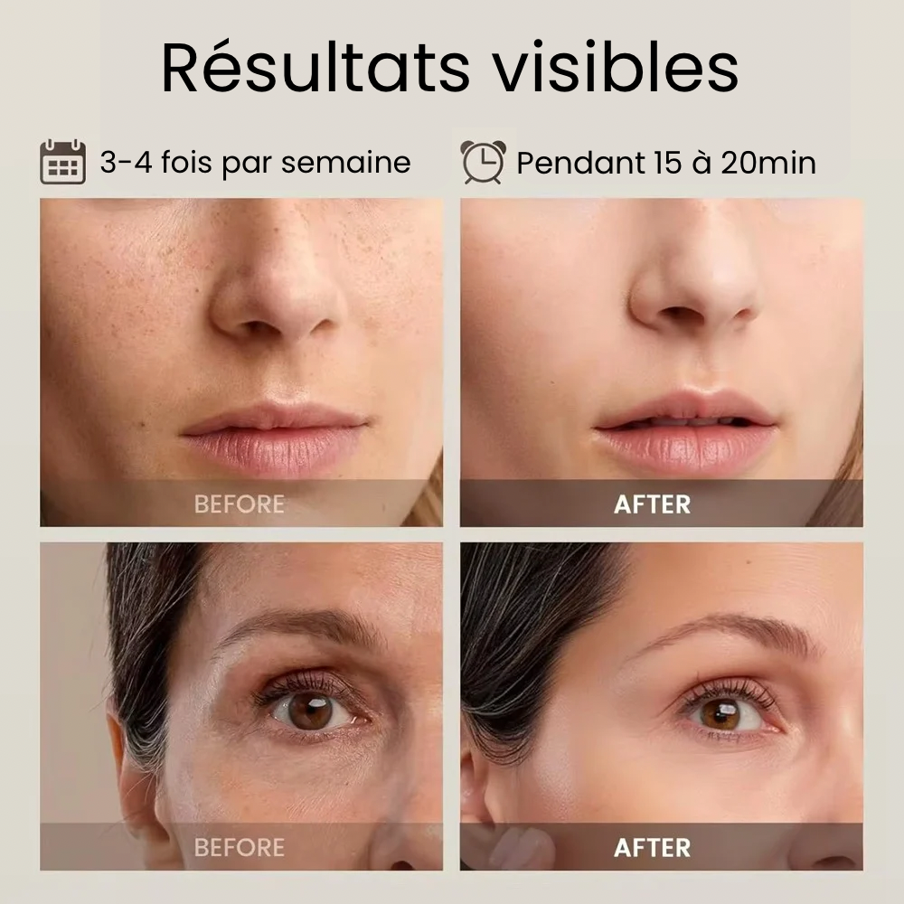 Masque à LED pour le visage